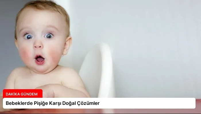 Bebeklerde Pişiğe Karşı Doğal Çözümler