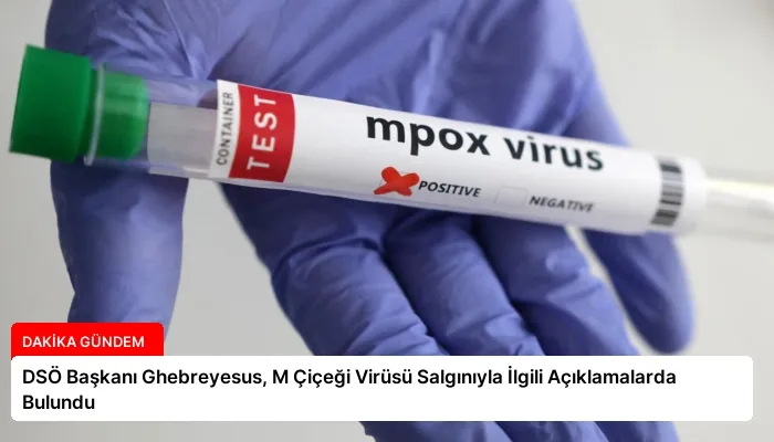 DSÖ Başkanı Ghebreyesus, M Çiçeği Virüsü Salgınıyla İlgili Açıklamalarda Bulundu