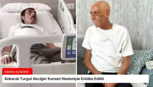 Ankaralı Turgut Akciğer Kanseri Nedeniyle Entübe Edildi